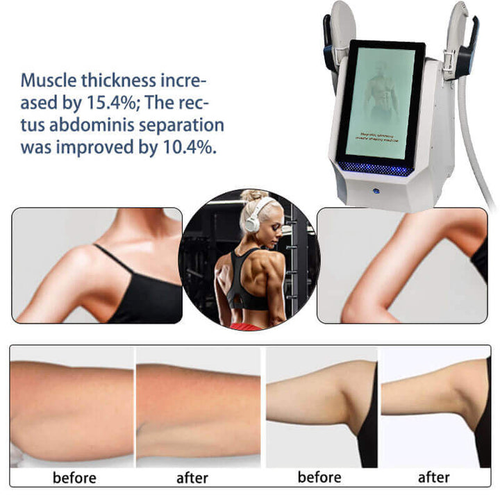 Slim Beauty Ems Muscle  Stimulator